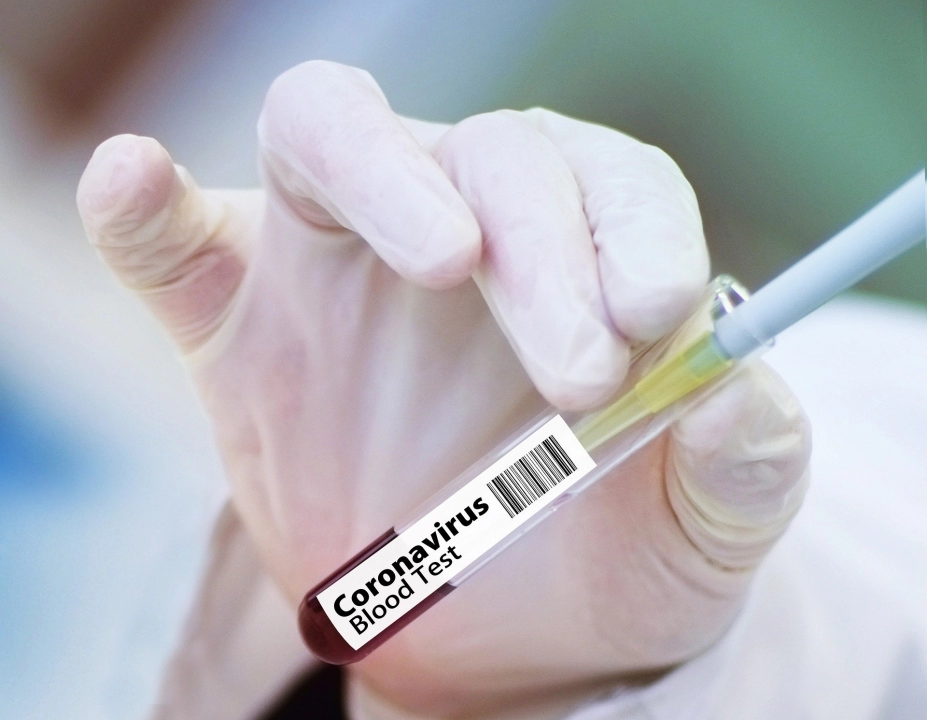 47 nowych przypadków koronawirusa w województwie. Wśród zakażonych troje dzieci
