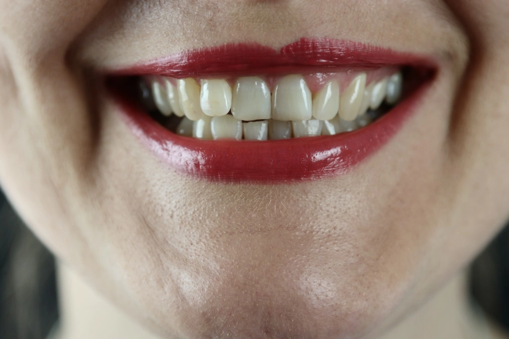 Higiena jamy ustnej - jak samemu zdiagnozować podstawowe problemy