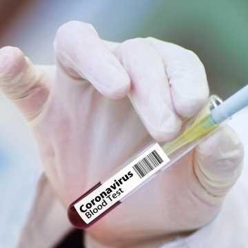 47 nowych przypadków koronawirusa w województwie. Wśród zakażonych troje dzieci
