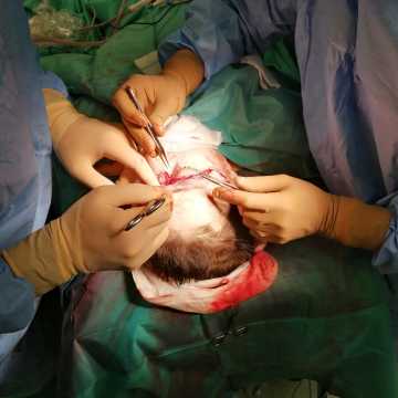 Kobieta, która uległa wypadkowi w zakładzie w radomszczańskiej strefie przeszła zabieg  replantacji skalpu