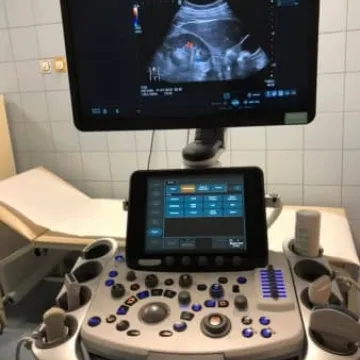 Szpital w Radomsku ma nowy aparat do badań USG