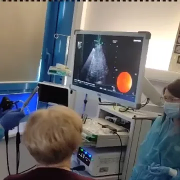 Pierwsze badanie EBUS w Szpitalu Powiatowym w Radomsku. Wszystko dzięki WOŚP