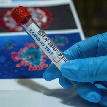 18 nowych przypadków koronawirusa. Wśród zakażonych roczne dziecko. 23 osoby wyzdrowiały